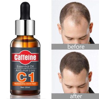 Mnm Box Deals | C1 Caffeine Essential Anti-Hair Loss Oil C1 Caffeine Essential Anti-hair Loss Oil - Image 3