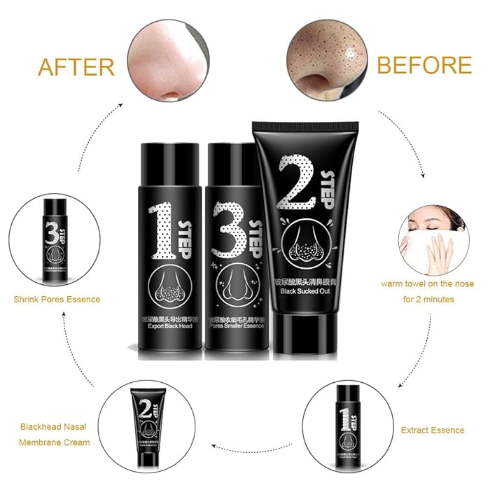Mnm Box Deals | 3 Step Blackhead Remover Kit 3 Step Blackhead Remover Kit - Image 3