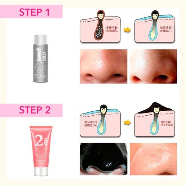 Mnm Box Deals | 3 Step Blackhead Remover Kit 3 Step Blackhead Remover Kit - Image 8