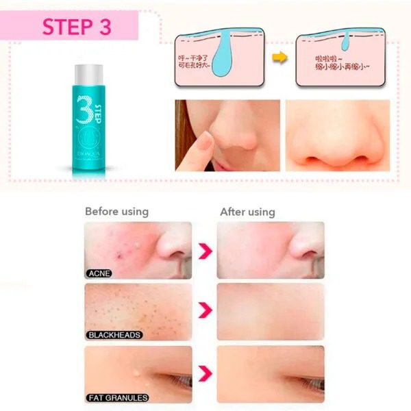 Mnm Box Deals | 3 Step Blackhead Remover Kit 3 Step Blackhead Remover Kit - Image 9