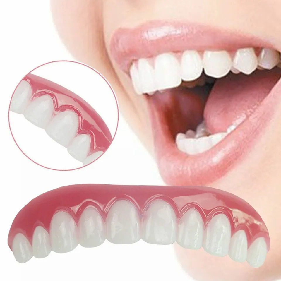 Mnm Box Deals | Perfect Smile Veneers Upper Teeth Perfect Smile Veneers Upper Teeth - Image 2