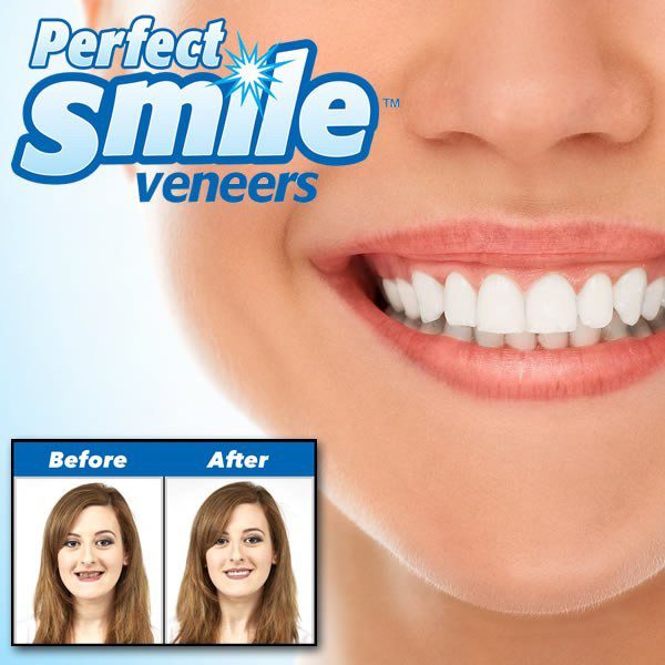 Mnm Box Deals | Perfect Smile Veneers Upper Teeth Perfect Smile Veneers Upper Teeth - Image 3