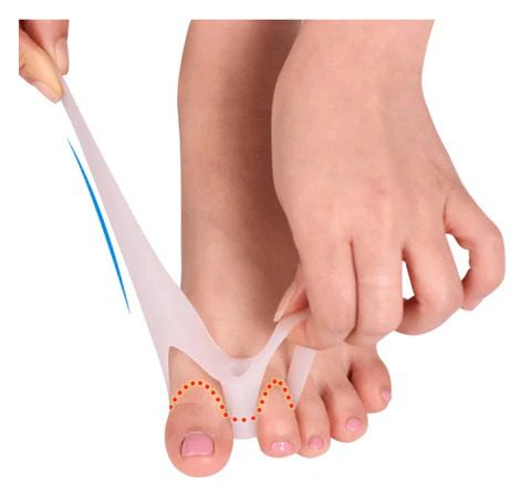 Mnm Box Deals | 1 Pair Silicone Toe Corrector 1 Pair Silicone Toe Corrector - Image 6