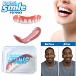 MnM Box Deals | Perfect Smile Veneers Upper Teeth