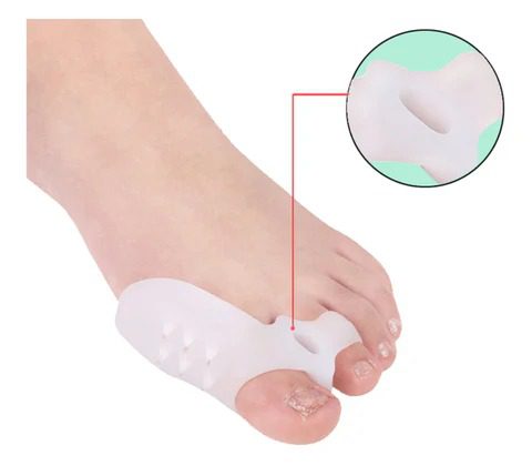 Mnm Box Deals | 1 Pair Silicone Toe Corrector 1 Pair Silicone Toe Corrector - Image 4